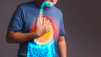 How GERD Surgery Can Significantly Improve Your Quality of Life