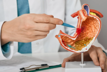 The Impact of Gastric Sleeve on Metabolic Health Beyond Weight Loss